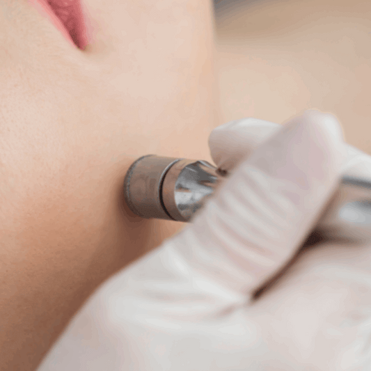 Peeling de Diamante (50 min)